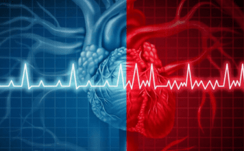 Tachicardia: Cause, Sintomi e Terapia