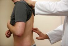 Fitte alla Schiena: Sintomi, Cause e Rimedi