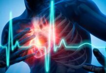 Aritmia: cause, sintomi, trattamento