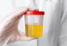 Ematuria: cause, sintomi, trattamento