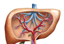 Epatomegalia: cause, sintomi, trattamento